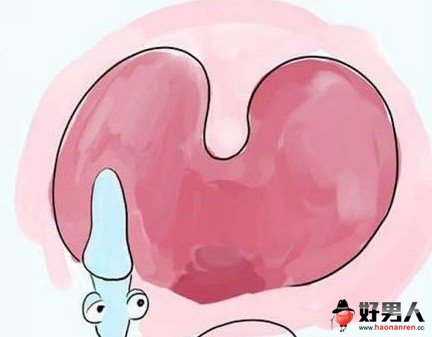 细数精子的15种悲催死法